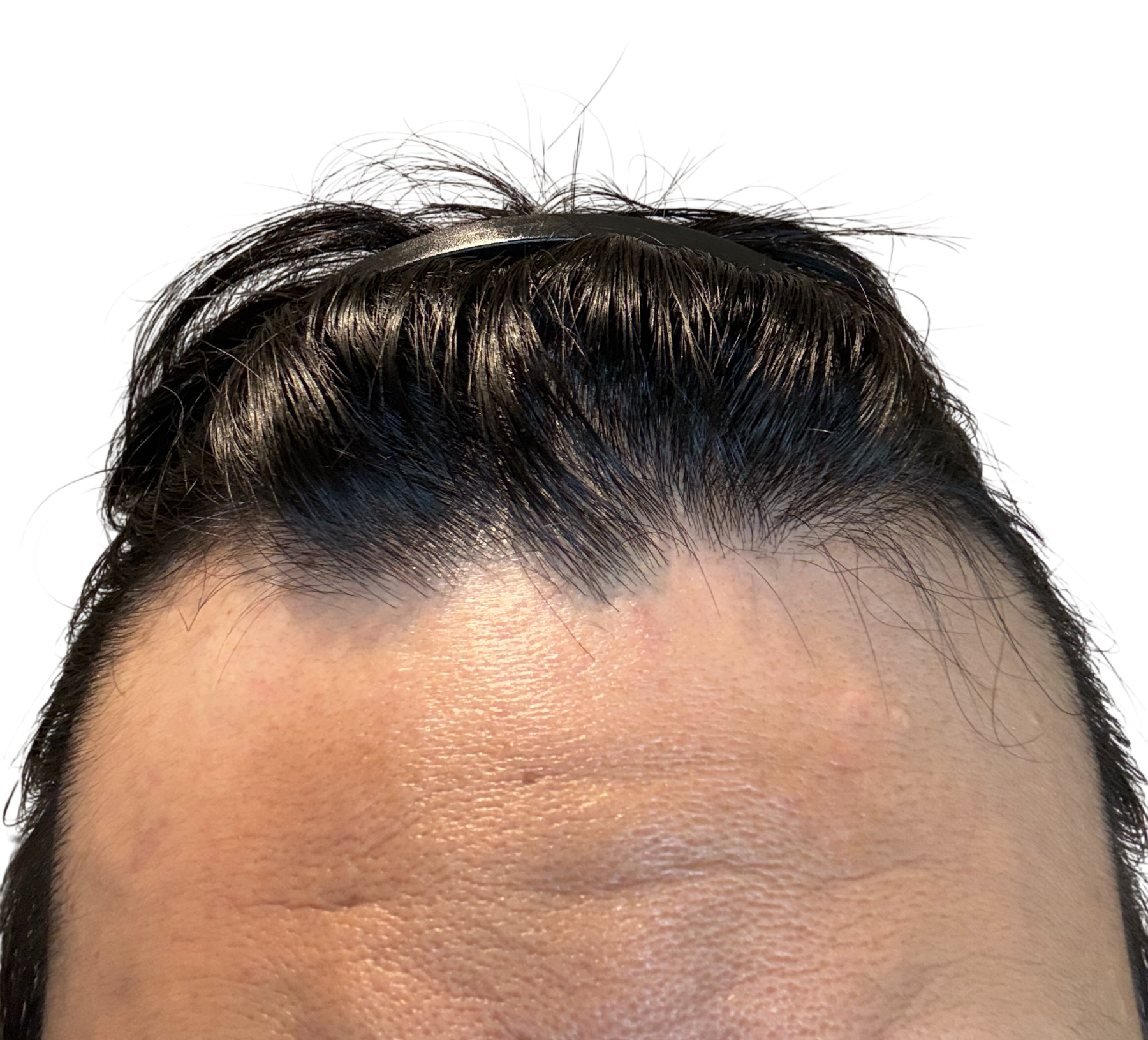 右側面